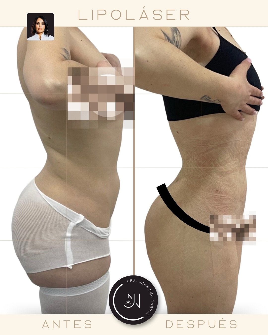 489888705_18371510974193391_2505422720272578662_n