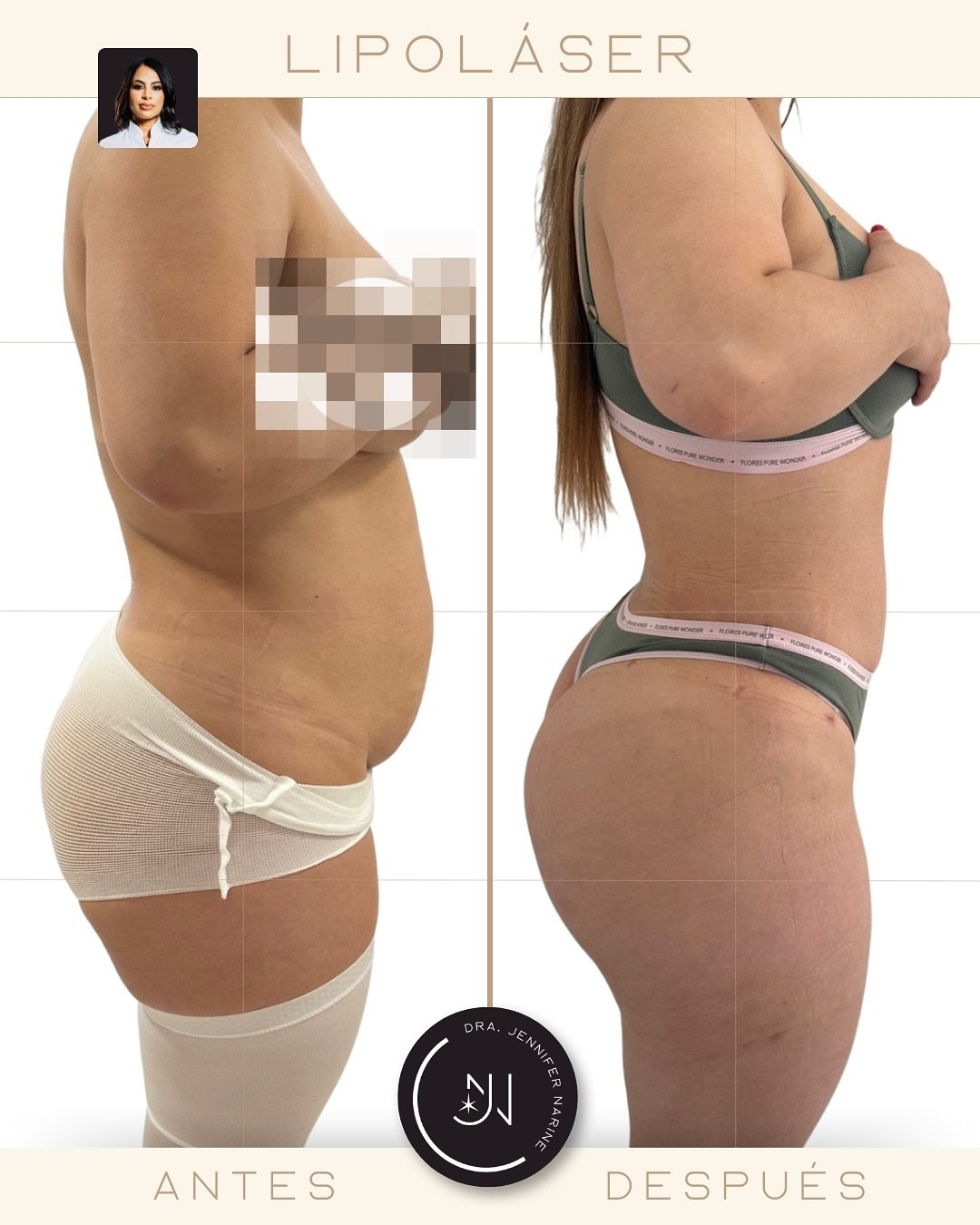 490782870_18371509435193391_8155663261577032154_n