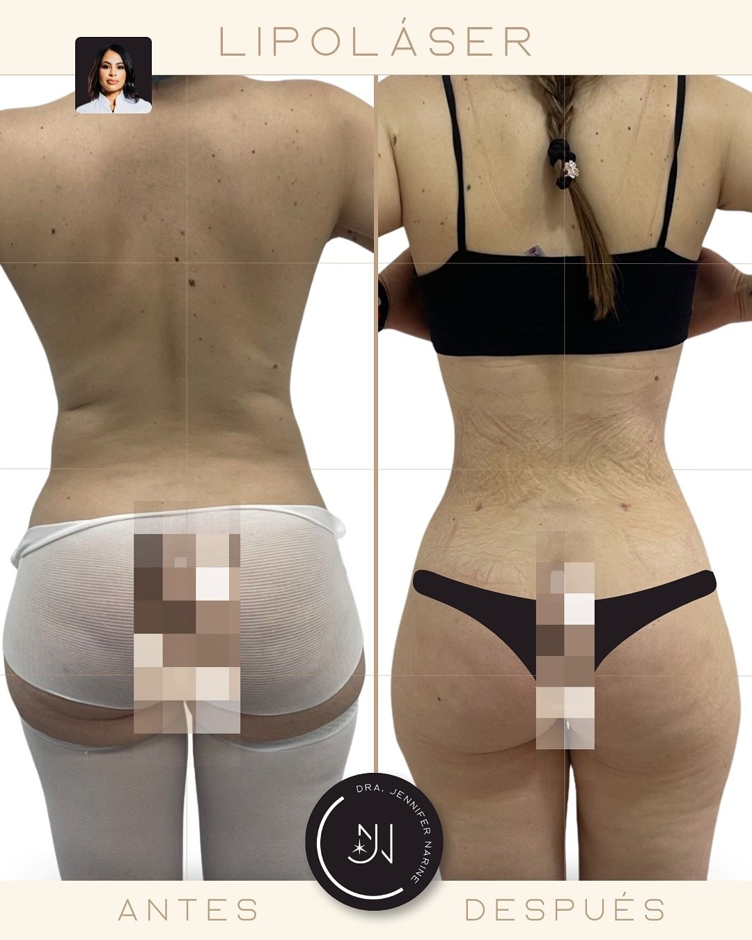 491414107_18371510866193391_6554864172554671570_n