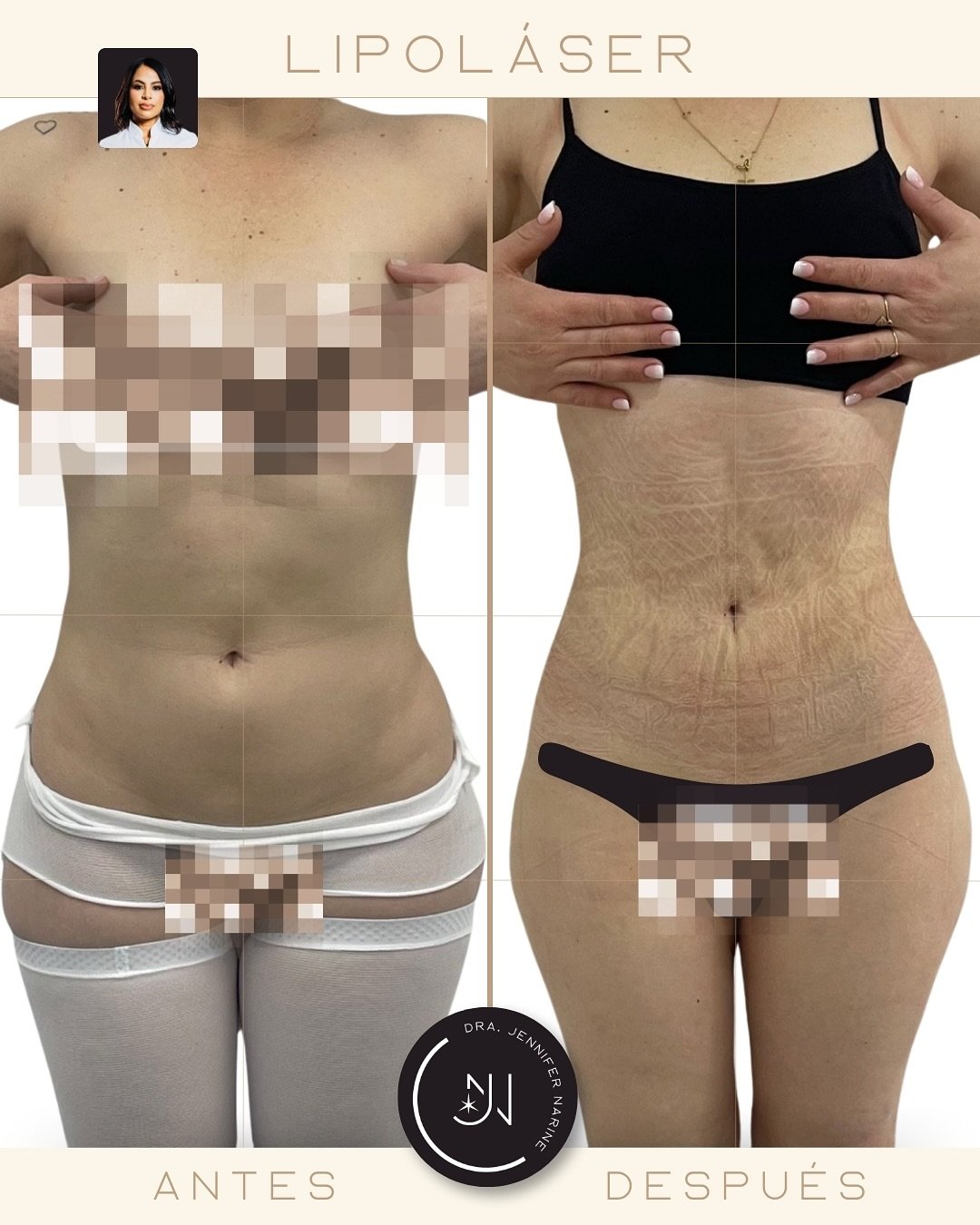 491415347_18371510836193391_1456650842833911102_n