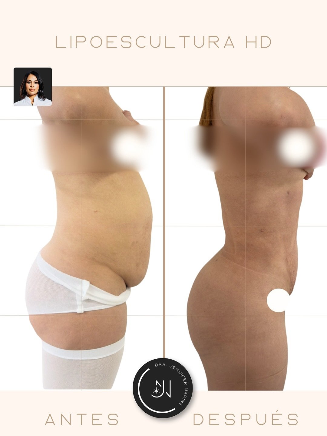 584375714_18404988955193391_2003444731466809139_n