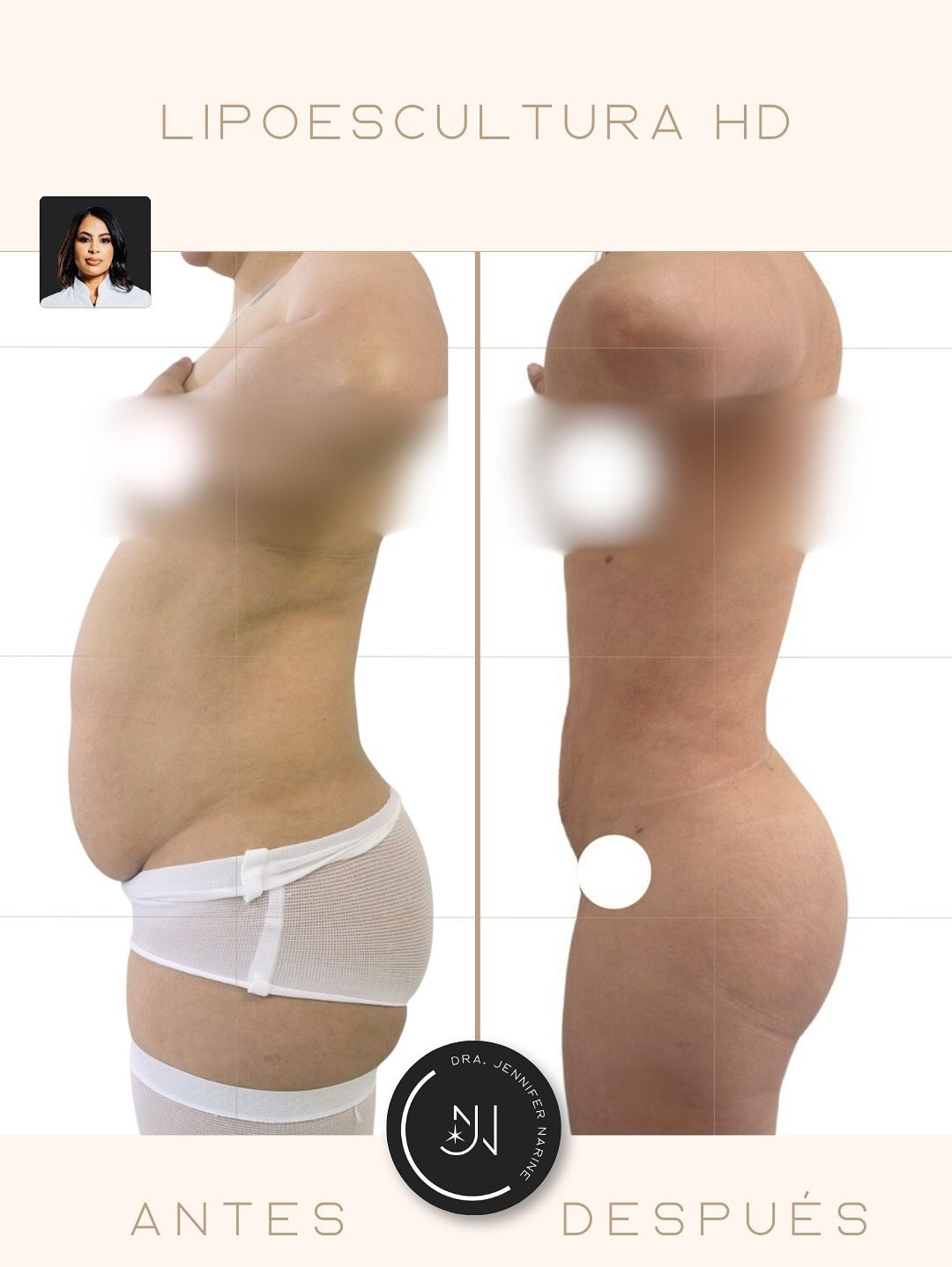 602012473_18404988937193391_7369726665922596273_n